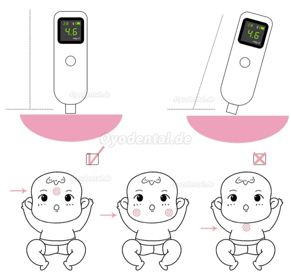 Luckcome L11C Neonatales Bilirubinmessger&auml;t Transkutanes Bilirubinometer Ikterus Messger&auml;t